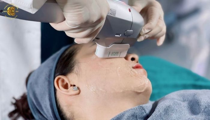 Các loại máy HIFU phổ biến trên thị trường