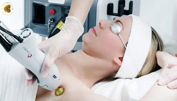 Vì sao nên đầu tư Máy Laser GentleMax Pro Candela?