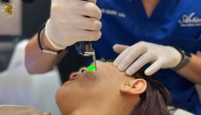 Công nghệ xung dài hỗ trợ nâng cơ và tái tạo collagen