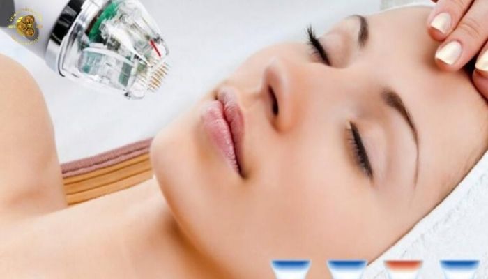 Máy vi kim phù hợp với những tình trạng da nào