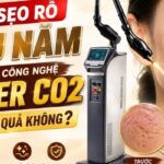 Với sẹo rỗ lâu năm, dùng công nghệ laser CO2 có hiệu quả không?