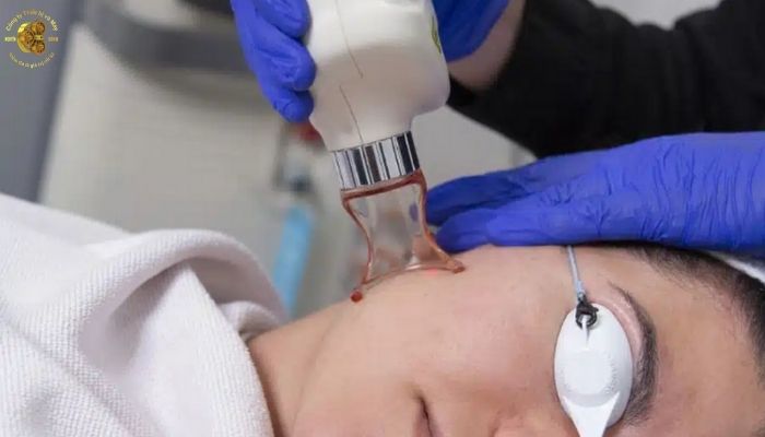 Những loại sẹo laser CO2 cải thiện tốt