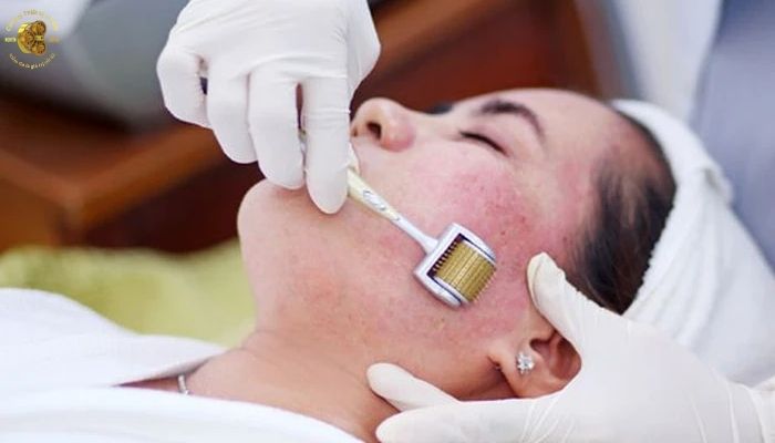 Laser CO2 có hiệu quả không khi so với các phương pháp khác?