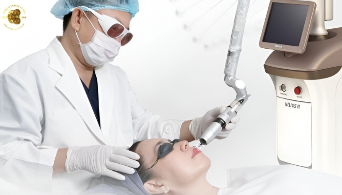 Công nghệ RTP trên Laser Helios III khác gì so với Q Switched thông thường?