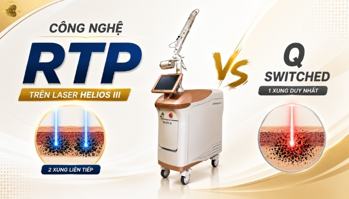 Những lưu ý để phát huy hiệu quả của công nghệ RTP
